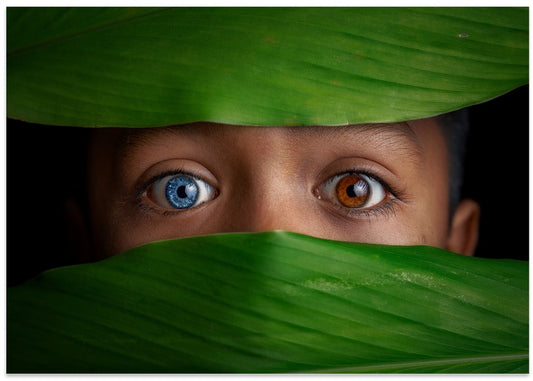 Different Colored Child Eyes